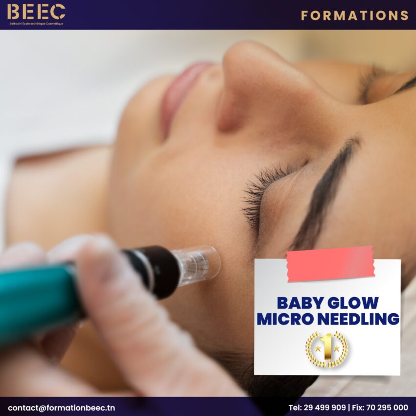 babyglow micro needling